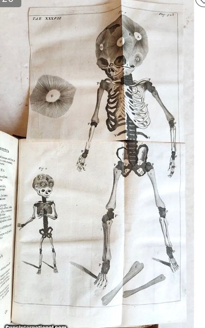“UFO alien anatomy photo” in 1772 ANATOMY illustrated ANTIQUE by Theodor CRAANEN Tractatus physico-medicus